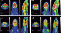 Animal study shows PET/CT can detect brain damage from TMT poisoning
