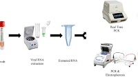 High sensitivity-low cost detection of SARS-CoV-2 by two steps end point RT-PCR with agarose gel electrophoresis visualization | Scientific Reports