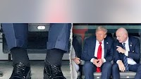 Doctors react to alleged Trump health concerns as photos show swelling and bruising