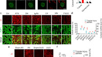 Polynucleotide phosphorylase protects against renal tubular injury via blocking mt-dsRNA-PKR-eIF2α axis