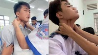 Doctors warn about dangerous ’pen-catching’ trend
