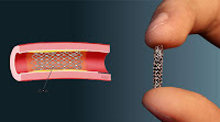 Heart rings prices in Bangladesh still relatively high