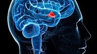 New Research Shakes Up Beliefs About Fat and Brain Health