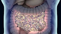 Botensilimab/Balstilimab Elicits Sustained Efficacy in MSS Metastatic CRC