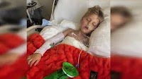 Utah boy suffers third-degree burns attempting a toy trend he saw on social media