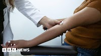 New blood test could detect ovarian cancer early, researchers say