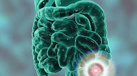 Investigational MK-1084 Demonstrates Antitumor Activity in Phase I Trial for Colorectal and Non-Small Cell Lung Cancers