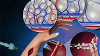 Combining novel biomaterial and microsurgery might enable faster tissue recovery