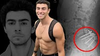 How a Freak Accident Turned Luigi Mangione Into a Vengeful Murder Suspect