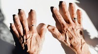 NAD aging: Benefits, risks, and more