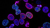 New plant-based gel to fast-track 'mini-organs' growth, improve cancer treatment