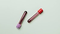 Blood test detects ovarian cancer with high accuracy, study finds