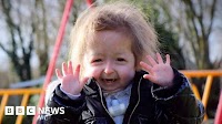 Life-changing DIY SOS home revamp for child with rare illness