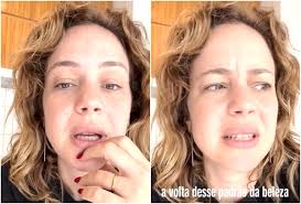 Leandra Leal explica falas sobre canetas emagrecedoras: 'Retrocesso'; famosos reagem