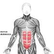 Le diastasis des muscles grands droits: quel traitement pour un