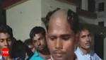 Groom demands dowry, gets head