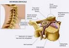 Arthrose cervicale : Symptmes et traitements pour soulager la