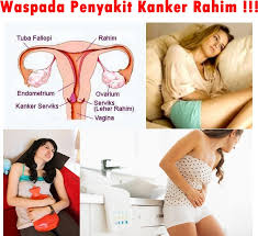 Image result for kanker