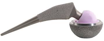Implantcast - Quadril - EcoFit® hip stem - Ortospine