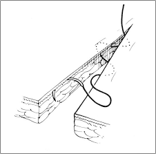 Image result for simple continuous suture pattern