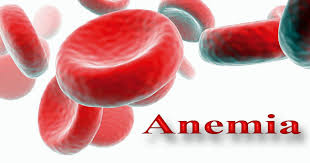 Resultado de imagen para ANEMIAS