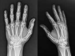 AI's Double-Edged Sword: Battling Fraud and Navigating Liability in Healthcare Insurance