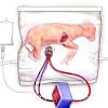 Story image for Cord Blood Gases In Newborns from Science Daily