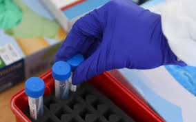 Trend Google: allarme meningite inghilterra