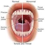 Estradiol hemihydrat rezeptur General discussion fo