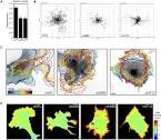 Vinculin, cell mechanics and tumour cell invasion