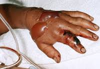 Résultat de recherche d'images pour "copperhead bites"