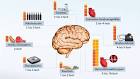 Alzheimer (Alzheimer-Krankheit, Morbus Alzheimer) Ursachen