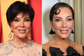 Kris Jenner's recent plastic surgery transformation