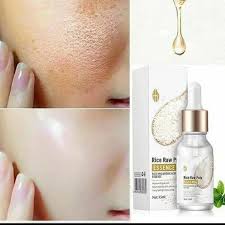 Suero de arroz Bioaqua ¿Qué es? Es un sérum facial con extracto de arroz, que ayuda a hidratar y suavizar la piel. Está formulado con una textura ligera y refrescante que se