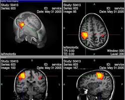 Imagen de Resonancia magnética funcional (fMRI)
