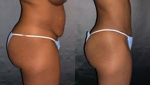 images?q=tbn:ANd9GcQEF3SqkHrAUKpBxt1kgnDZl9dnPBFWvZ7sbjYSjerd-1Sp-YqRPA