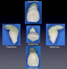 Résultat de recherche d'images pour "shovel shaped incisors"