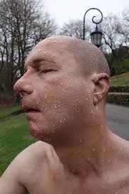 Image result for tony matelli