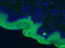 Pathology Outlines - Cytokeratins (CK) - general