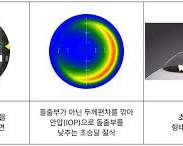 라식 수술 후 개선된 시력 이미지