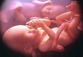‫اهدای جنین‬‎ ile ilgili görsel sonucu