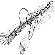 Image result for simple continuous suture pattern