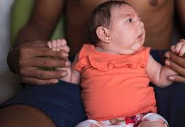 Image result for photo of zika virus