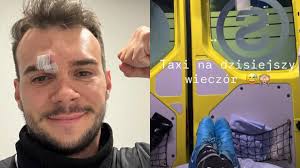 Albert Kosiński uległ wypadkowi i trafił do szpitala. "Łuk brwiowy rozcięty"