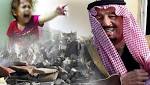 قرابة ألف طفل يمني ماتوا