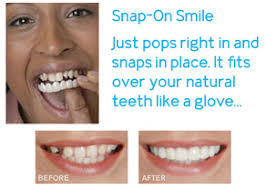 ... resin make it very thin yet extremely strong. It fits right over your own teeth to give you a beautiful, natural looking smile—even if you have stains, ... - Snap-on_Smile