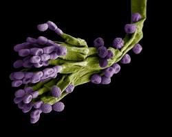 Hình ảnh về Penicillium fungi