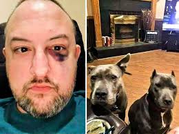 Pit bulls defend owner from thieves