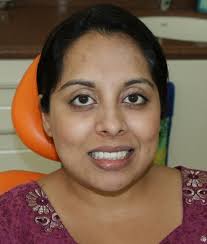 Kalpana Singh US NRI (Modesto CA) Zoom Ap Teeth Whitening &amp; Two Dental veneers ceramic (zirkonium , zirkonia )( Maxllary ... - DSC03711.268181132