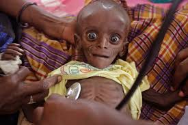 Résultat de recherche d'images pour "children starving"